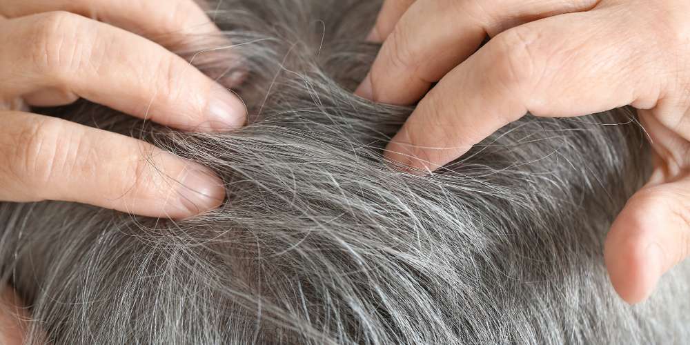 Das Dilemma der grauen Haare: Kann man sie verhindern?