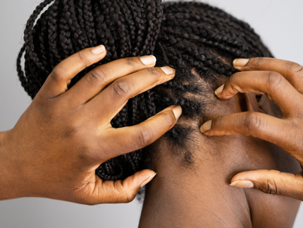 Wenn die Kopfhaut schmerzt: Alles über Kopfhaut Entzündungen