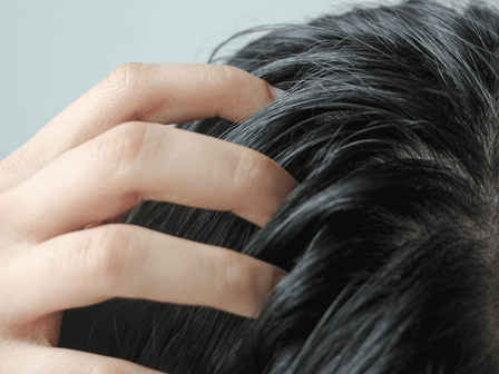 Das optimale Kopfhaut Peeling bei Kopfhautproblemen