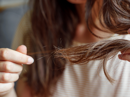 Plötzlich starker Haarausfall bei Frauen
