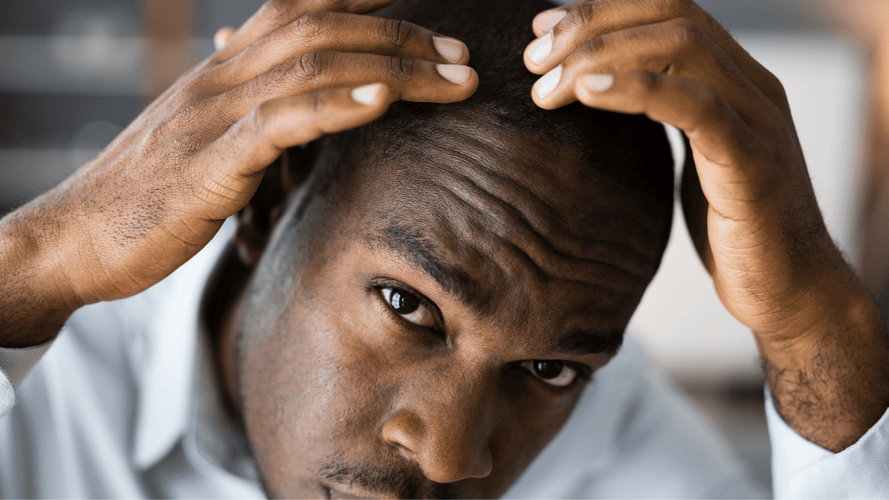 Piroctone Olamine und Ketoconazol: Die Wirkung auf den Haarwuchs