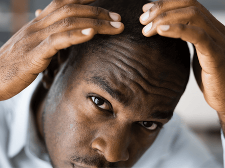 Piroctone Olamine und Ketoconazol: Die Wirkung auf den Haarwuchs