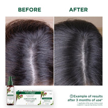 Klorane Anti-Haarausfall-Behandlung