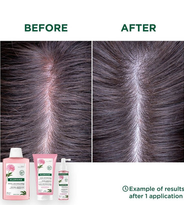 Klorane Shampoo Pfingstrose - empfindliche Kopfhaut (400 ml)
